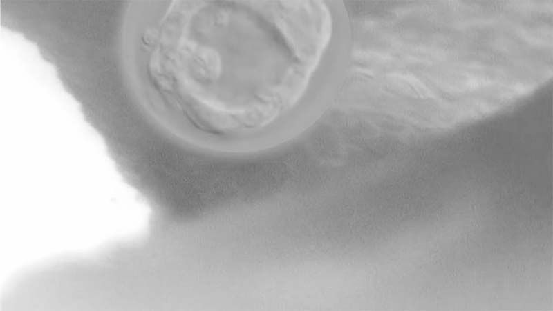 Blastocyst attached to uterus