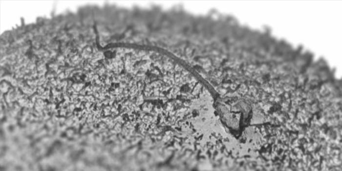 Spermatozoa penetrating egg