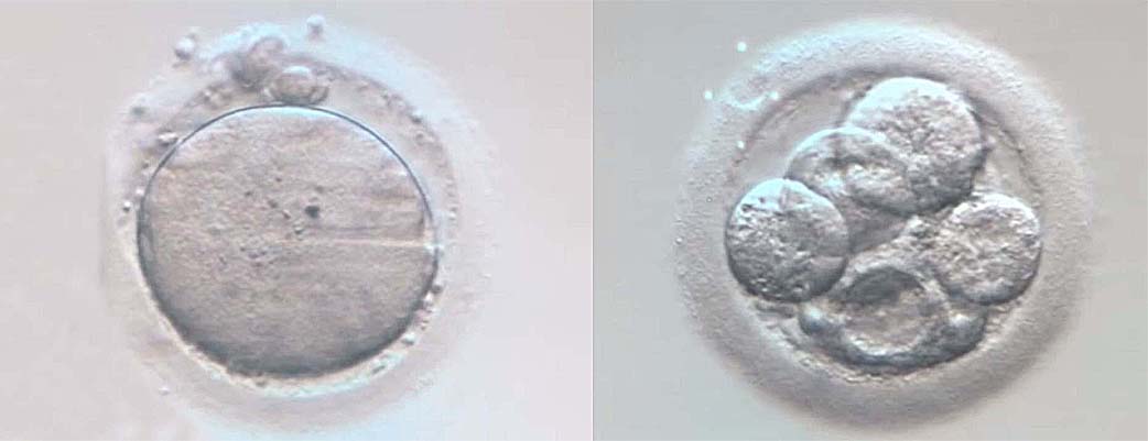 Zygote