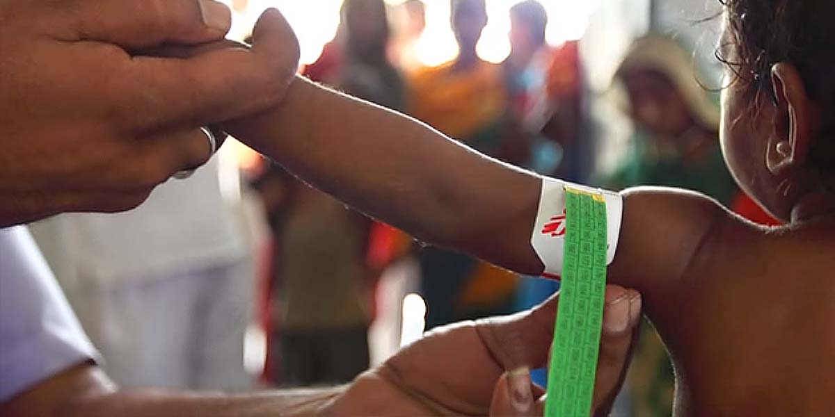 Measuring Malnutrition